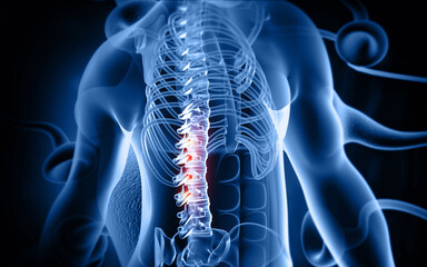 Human back pain spine disc bulge. 3d illustration.