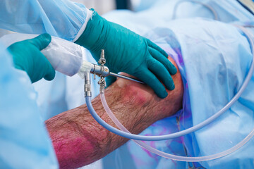 Team doctors use medical instrument for operating room hospital.