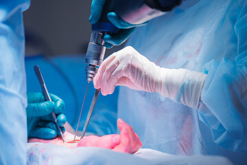 Surgeon performs surgery on patient hand closeup, doctor uses drill to install pin screw to...