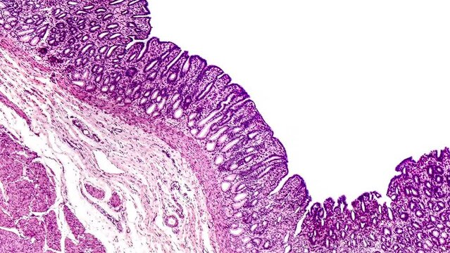 Light micrograph footage showing a cross-section of the stomach displaying its mucosa, submucosa, and muscularis externa layers.