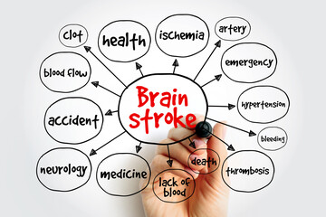 Brain stroke mind map, medical concept for presentations and reports