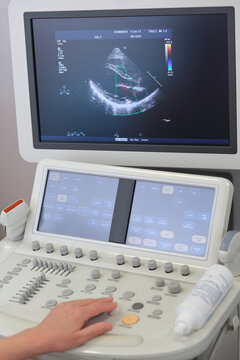  Modern ultrasound system, monitor and control panel in multidisciplinary clinic CELT
