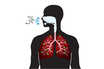 Breathing unhealthy levels of pollution from fine particulates (PM2.5) can increase the risk of health problems like heart disease, asthma, and low birth weight.