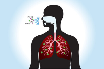 Breathing unhealthy levels of pollution from fine particulates (PM2.5) can increase the risk of health problems like heart disease, asthma, and low birth weight.