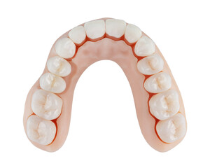 Dental model of teeth top view isolated on white background. Artificial crowns and gums, implants.