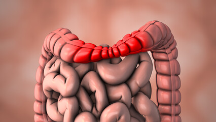 Medical animation of the irritable bowel syndrome