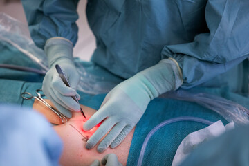 Midsection of surgeon operating abdomen of patient in hospital