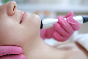 Close-up of Oxygen Mesotherapy Procedure on Facial Skin. A detailed close-up of a skincare...