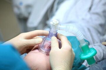 Anesthesia during surgery. Oxygen mask on the child's face. Surgical intervention.