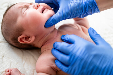 Doctor checking baby's neck for rashes and skin irritation.