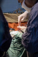 neurosurgeon , doing surgery, operation theater, subdural hematoma in the brain, multiple neurosurgeon, open brain surgery.