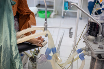 neurosurgeon , doing surgery, operation theater, subdural hematoma in the brain, multiple...