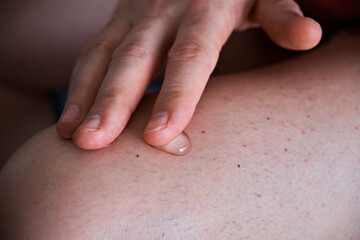 A man touches an anti-inflammatory healing cream with his finger to rub on his leg. Treatment of arthrosis and arthritis, anti-inflammatory ointment for the treatment of joints, close-up, medicine