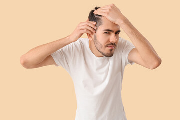 Fototapeta premium Young man with hair loss problem on beige background