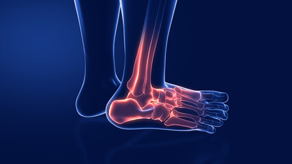 sprains and dislocations to the ankle