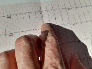 Mano di un dottore sull'esito dell'elettrocardiogramma