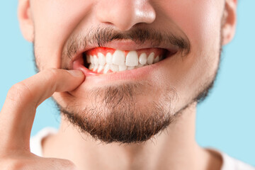 Handsome young man with healthy teeth on blue background, closeup. Dental care concept