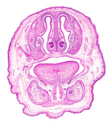 Frontal section of embryo’s head