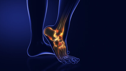 Medical animation for ankle pain - obrazy, fototapety, plakaty