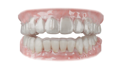 Dental orthodontic clear aligner