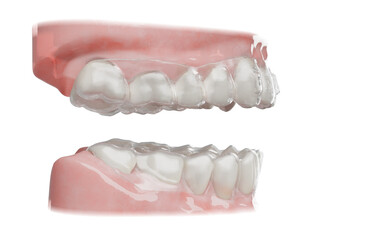 Dental orthodontic clear aligner