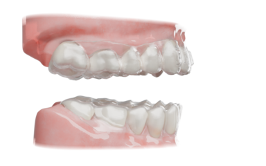 Dental orthodontic clear aligner