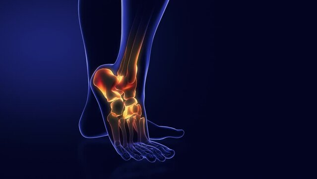 Medical animation for ankle pain