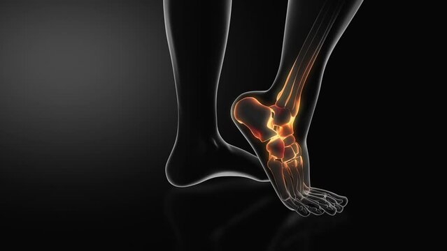 Medical animation for painful ankle