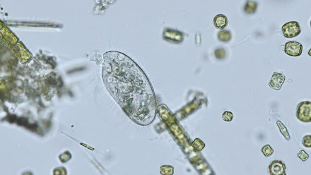 Pleuronema coronatum under the microscope - unicellular ciliated organism