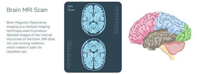Brain MRI scan vector illustration. Magnetic resonance imaging is a medical imaging technique used in radiology to form pictures of the anatomy and the physiological processes inside the mind. 