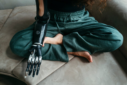 Person with prosthetic arm.