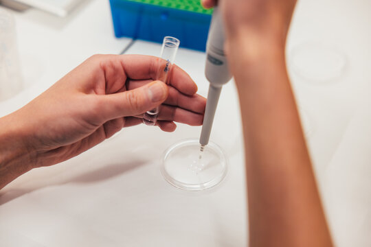 Hand holding a specimen plate with medical pipette