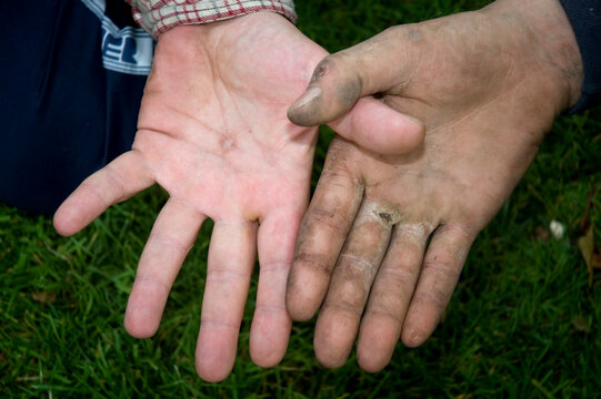 Two different hands