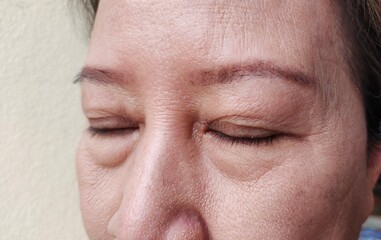 portrait showing the wrinkle and Flabby skin, swelling and loose under the eye, dark spots and blemish, Flabbiness and freckle on the face of the woman, health care and beauty concept.