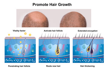 Hair growth phase, anatomy diagram of human hair