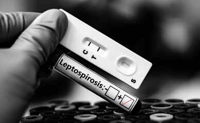 Blood sample of patient positive tested for leptospirosis by rapid diagnostic test.