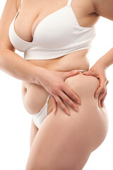 The girl stretches the skin on the leg and on the stomach, showing fat deposits. Treatment and...