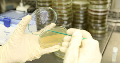 microbiology. microbiologist petri dish microbiology lab science research in protective gloves...