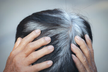 Back view of young people premature gray hair, showing black hoary hair roots on head change to...