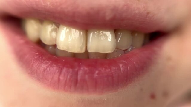 Smiling girl shows yellow teeth to the camera. dental problems, cracked teeth