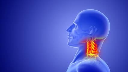 Whiplash mechanism in cervical spine or neck injuries