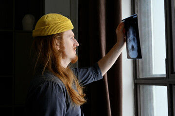 A young red-haired guy looks at his x-ray in front of the window