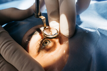 Vision correction with microscope. Surgeon's hands in gloves performing laser eye vision...