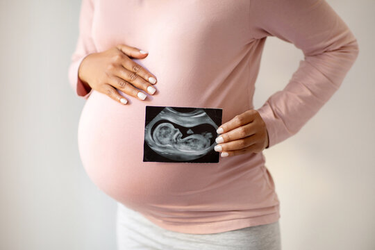 Pregnant woman lovingly showing her ultrasound photo and tenderly embracing belly