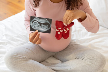 Young pregnant woman holding sonogram next to tiny red heart-patterned baby socks