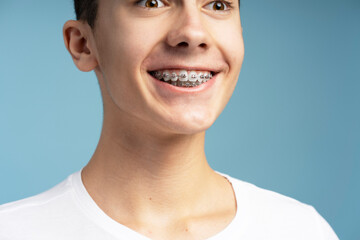 Attractive excited boy with orthodontic braces looking away standing isolated on blue background