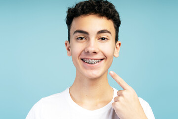 Positive attractive boy with braces pointing finger to mouth, looking at camera