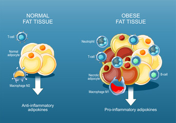 Adipose tissue and Obesity and inflammation. Close-up of a Fat cells.