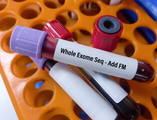 Blood sample for Whole Exome Sequencing Comparator - Additional FM test. It's a genetic test used...