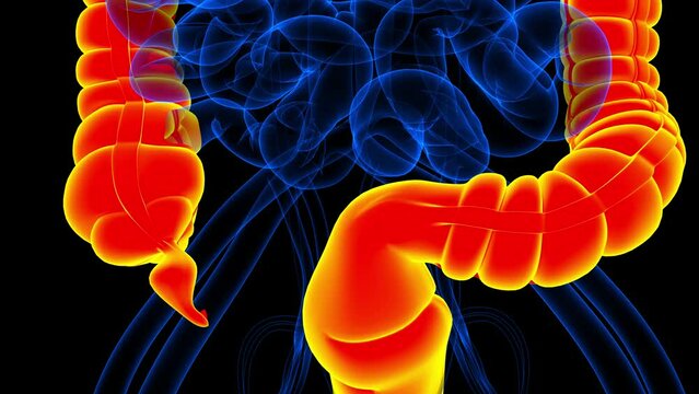 appendix pain anatomy for medical concept showing normal size to inflamed appendix 3d illustration